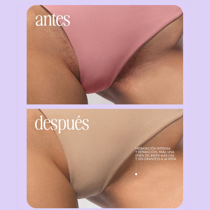 Velira™
